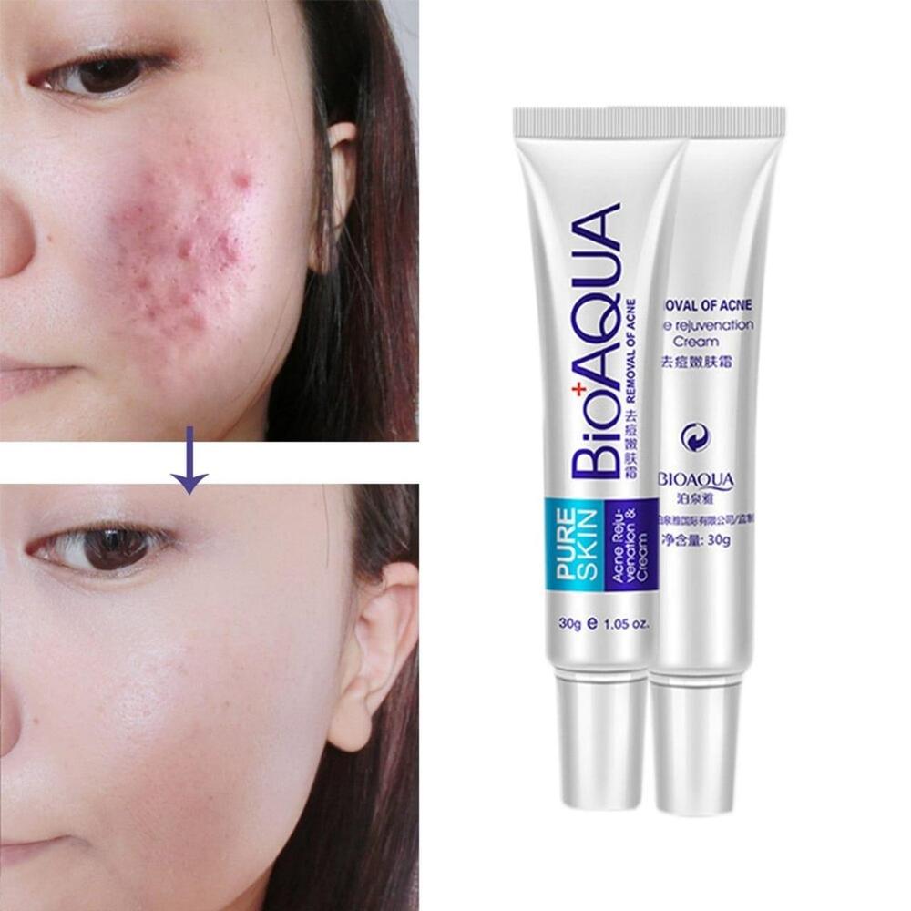 BioAqua Pure Skin Acne Scar Removal Cream 50g
