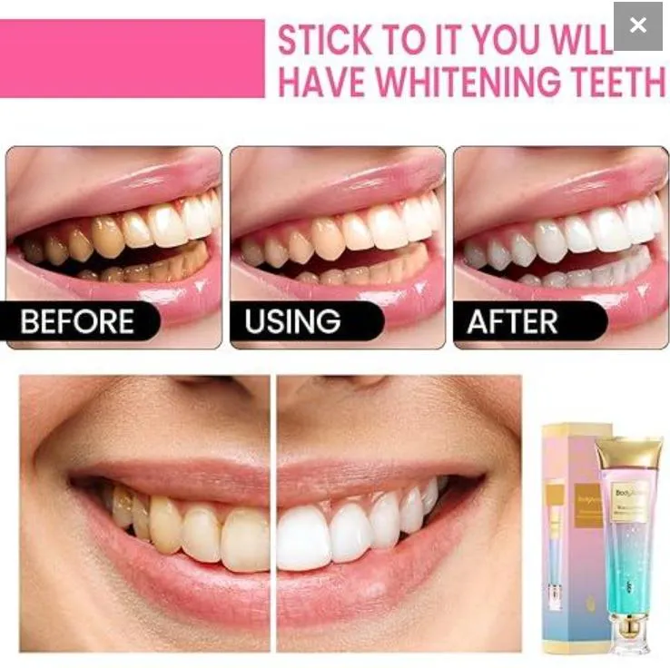 Body Accel Teeth Whitening Toothpaste Non-Irritating Cream