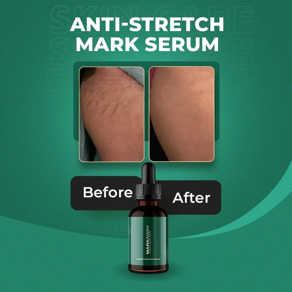 Markaway Stretch Mark Serum for Scar Reduction & Collagen Boost