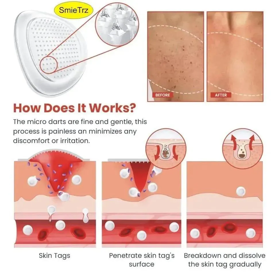 DermaSmooth Skin Tag Remover Patch White 40pcs
