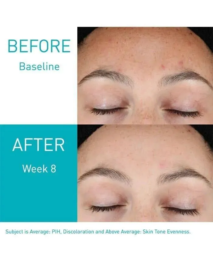 CeraVe Skin Renewing Retinol Serum 30ml for All Skin Types